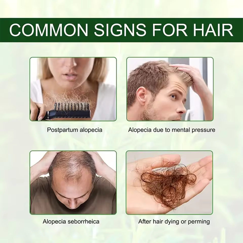 Bio-Rosmarin-Minz-Haaröl – Natürliches Haarwachstum und Kopfhautpflege