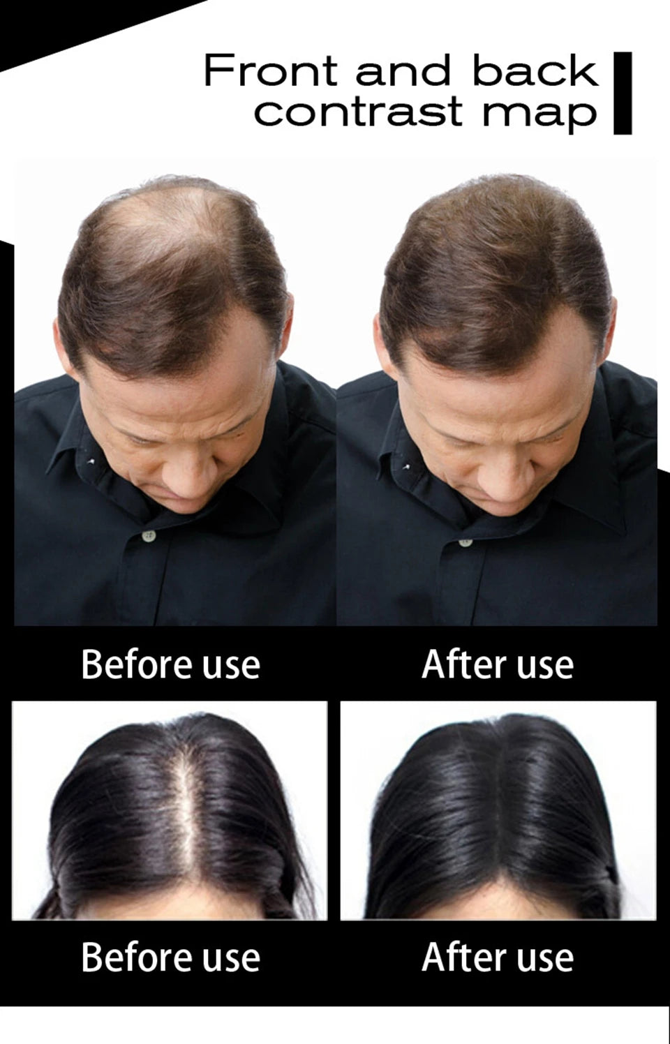 Sevich Haarfasern 10 Farben Keratin Haaraufbaufaser Pulver Sofortiges Haarwachstum