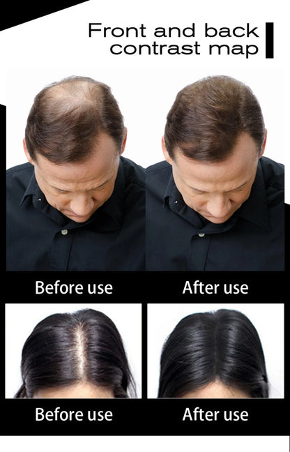 Sevich Haarfasern 10 Farben Keratin Haaraufbaufaser Pulver Sofortiges Haarwachstum