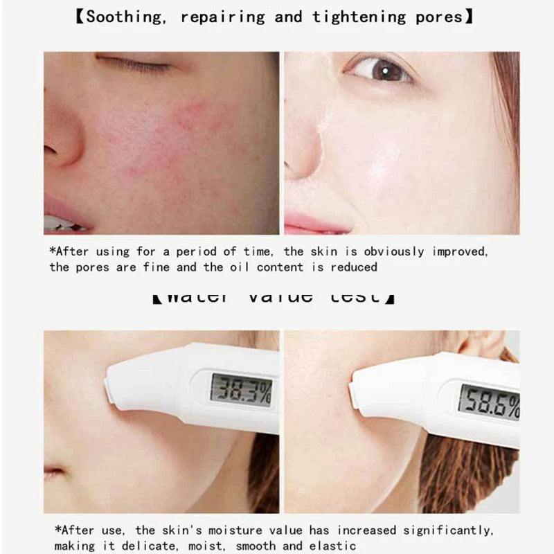Centella Collagen Schlafmaske – Tiefenwirksame Feuchtigkeits- und Anti-Aging-Behandlung über Nacht