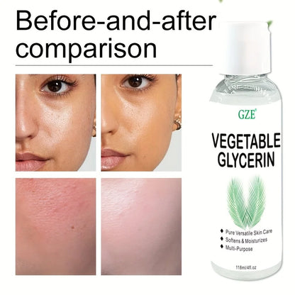 GZE Pflanzliches Glycerin – 100 % reine und natürliche Feuchtigkeitscreme für die Haut
