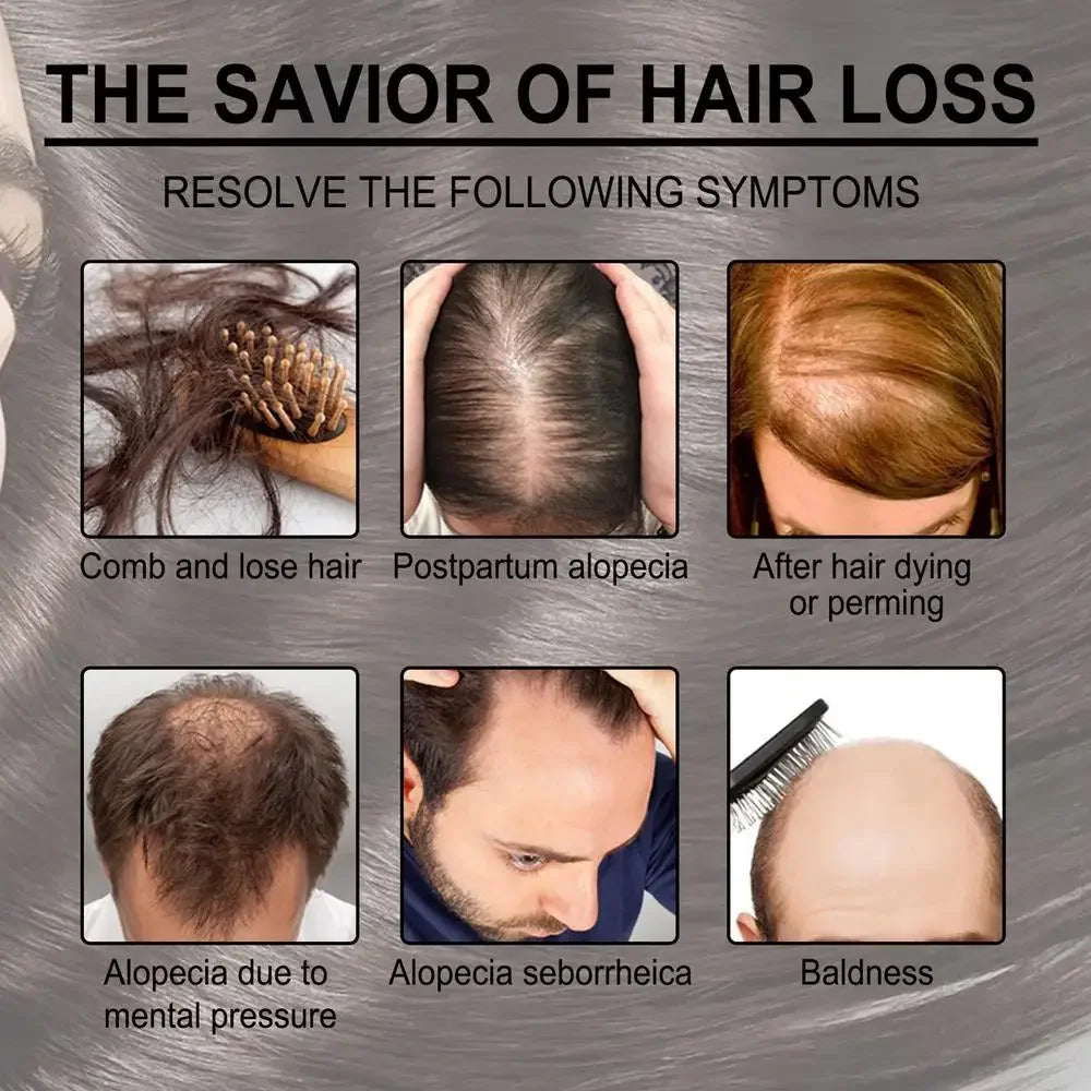 Ätherisches Rosmarinöl für Haarwachstum – Stärken und nähren Sie Ihr Haar auf natürliche Weise