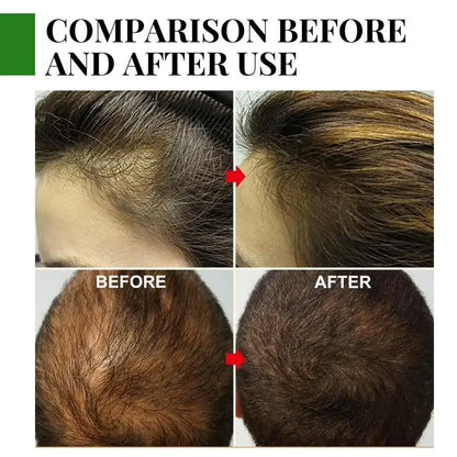Ätherisches Rosmarinöl für Haarwachstum – Stärken und nähren Sie Ihr Haar auf natürliche Weise